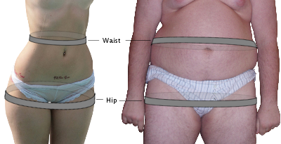 Waist Hip ratio